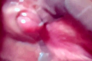 Amateur pink area 170 days after first time.