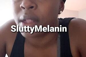 I got a yest infection on my penus and it hurts so bad