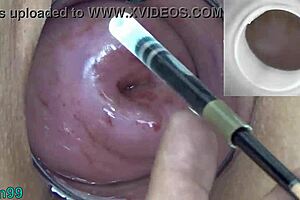 mature milf cervix play with endoscope japanese cam into uterus