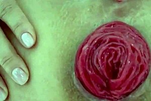 Watch the destroyed anal prolapse up close in this extreme play.