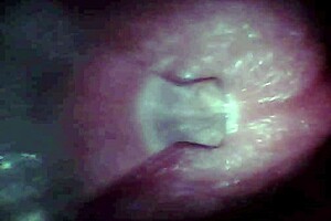 Wow! Endoscope Camera Captures Huge Cock Ejaculation Moment In Pov!