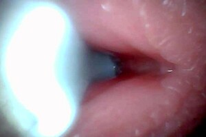 Wow! Endoscope Camera Captures Huge Cock Ejaculation Moment In Pov!